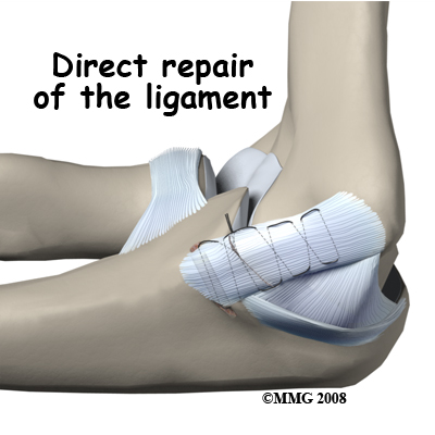 Ulnar Collateral Ligament Injuries