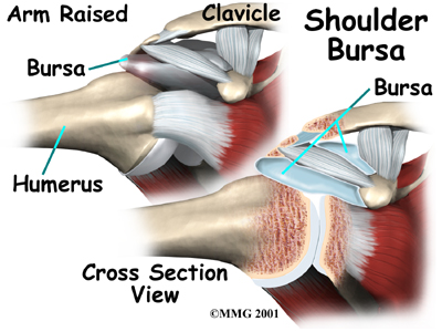 Reverse Shoulder Arthroplasty